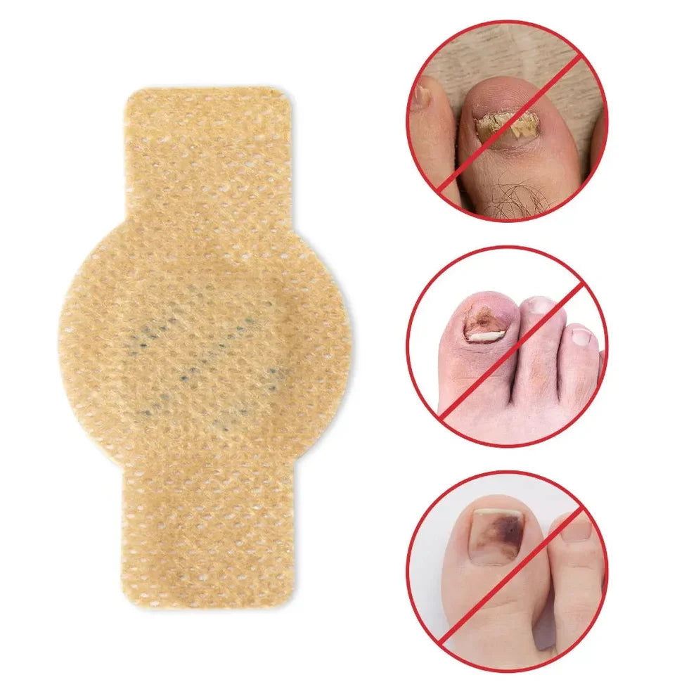 #1 Fungal Nail Patches