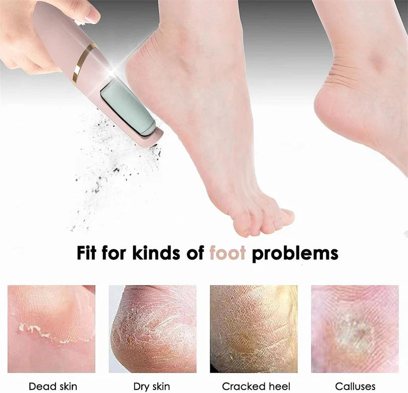 Electric Callus Remover for Feet